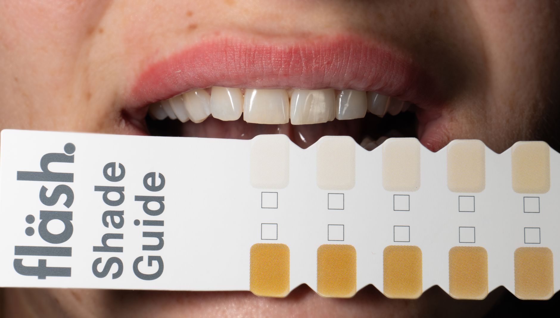 Dentiste installant un onlay en céramique conçu par imagerie numérique en clinique