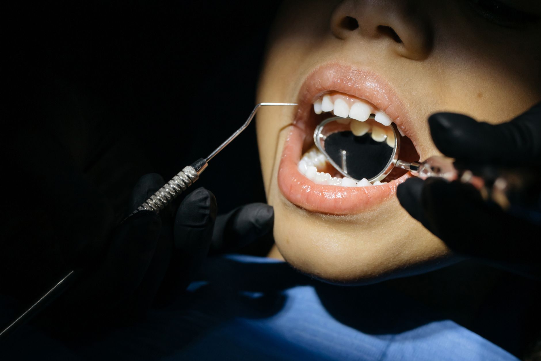Dentiste examinant les dents d'un patient pour détecter une carie entre les dents