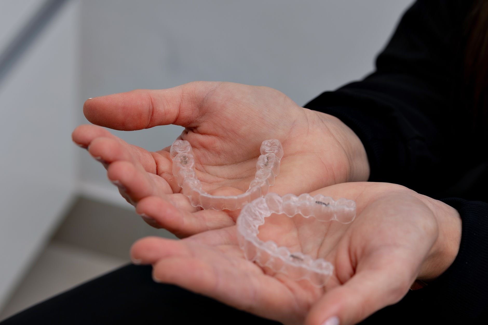 Comparaison entre broches dentaires métalliques et aligneurs transparents pour corriger l'alignement des dents