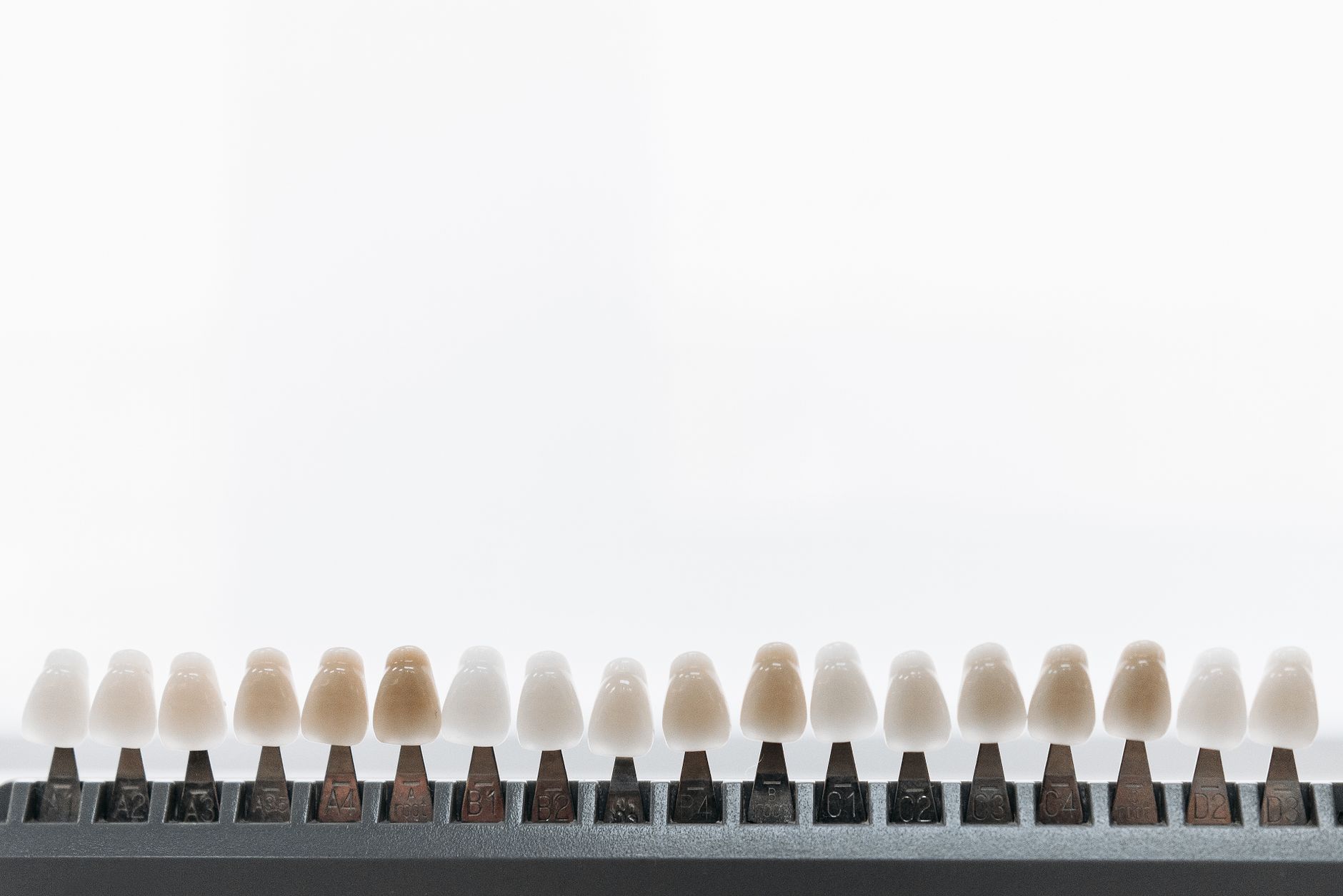 Comparison of porcelain veneers and composite veneers on the upper front teeth
