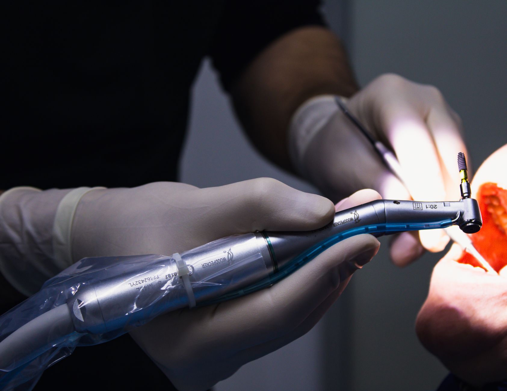 Smiling relieved patient after a successful root canal at a South Shore dental clinic