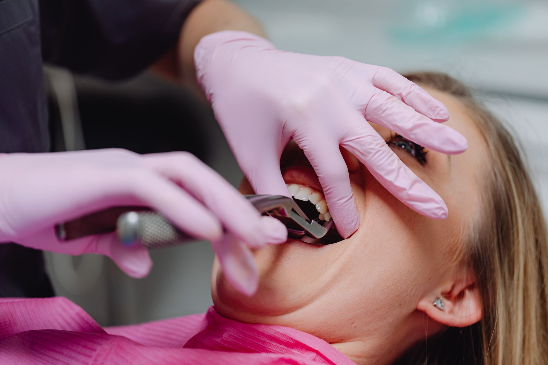 Root canal vs extraction comparison showing a natural tooth to save or remove at the dentist