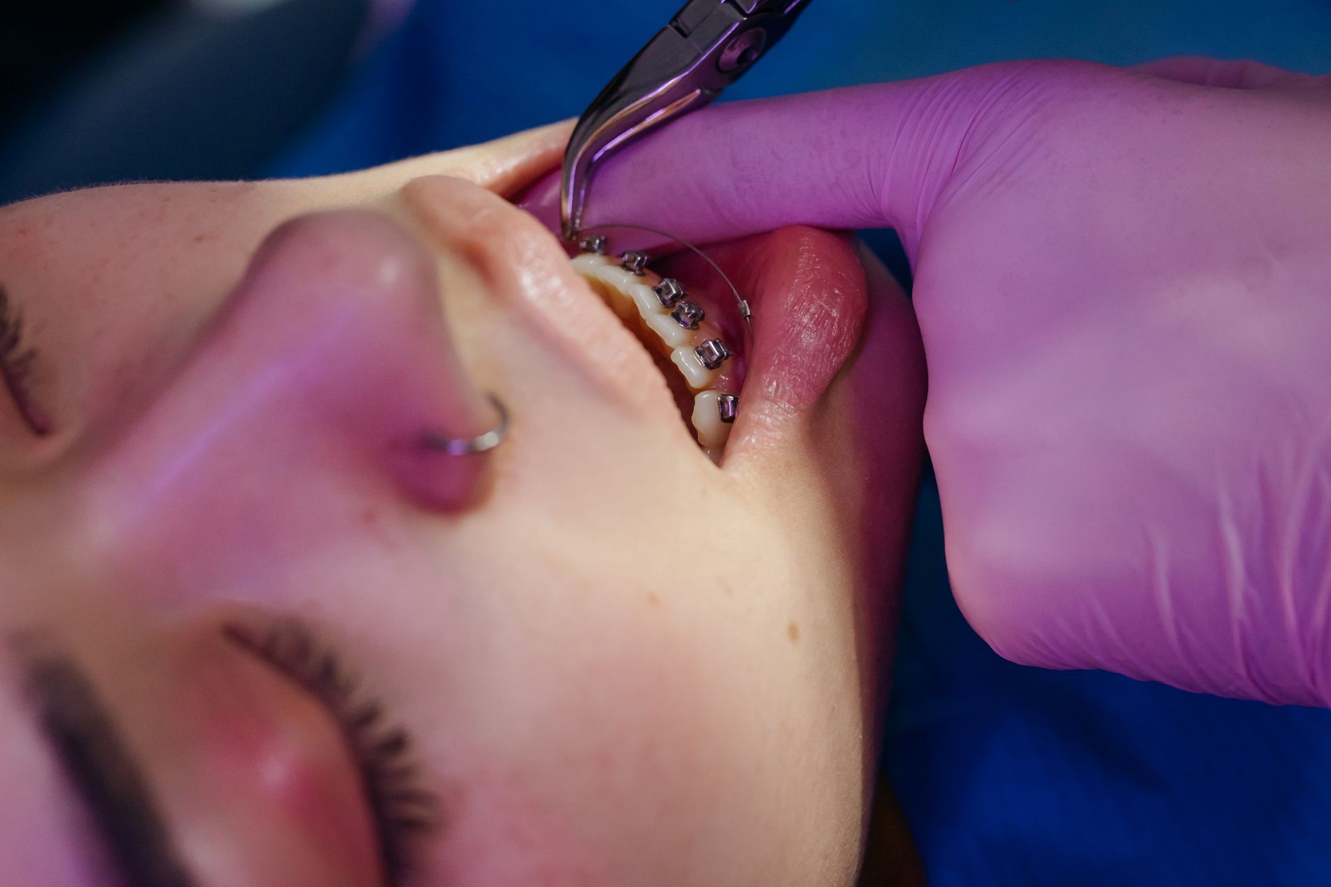 Child at first orthodontic exam around age seven with mixed dentition visible